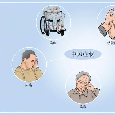 脑中风的先兆有哪些(脑中风的先兆是什么) 脑中风的先兆有哪些(脑中风的先兆是什么)
